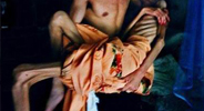 艾滋病患病情况（组图）