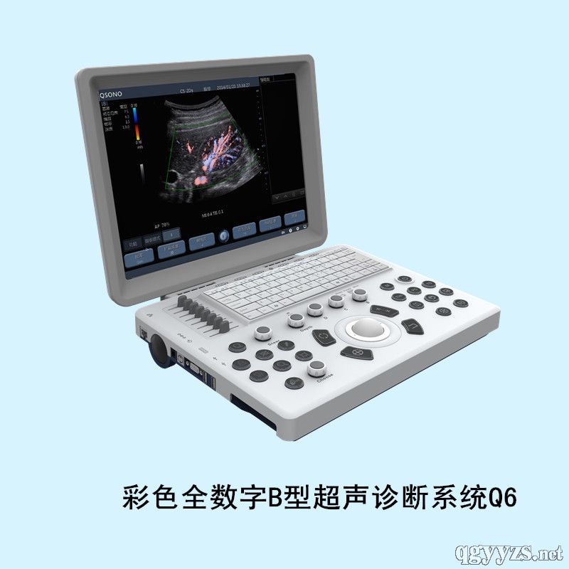 ��ɫȫ����B�ͳ������ϵͳQ6